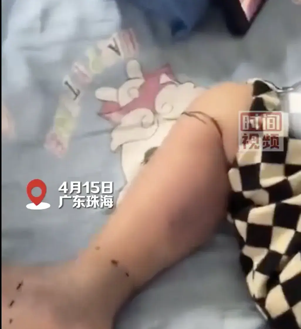 索赔22万！女子超市买鱼被刺八级伤残，每天得剜去腐肉，法院判了-图10